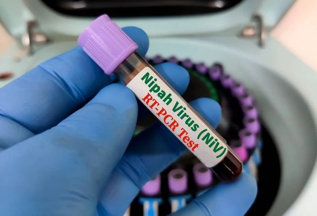 7 Cara Lindungi Diri dari Ancaman Virus Nipah, Imbauan Kemenkes RI