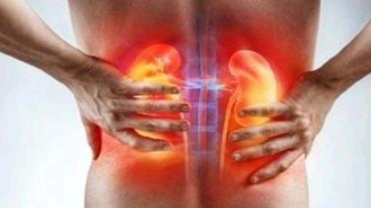 5 Kebiasaan Sepele yang Berisiko Merusak Ginjal, Waspadai Sebelum Terlambat